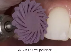 A.S.A.P. Pre-polisher on anterior teeth