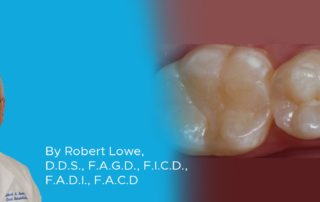 Composite Resin Restorations