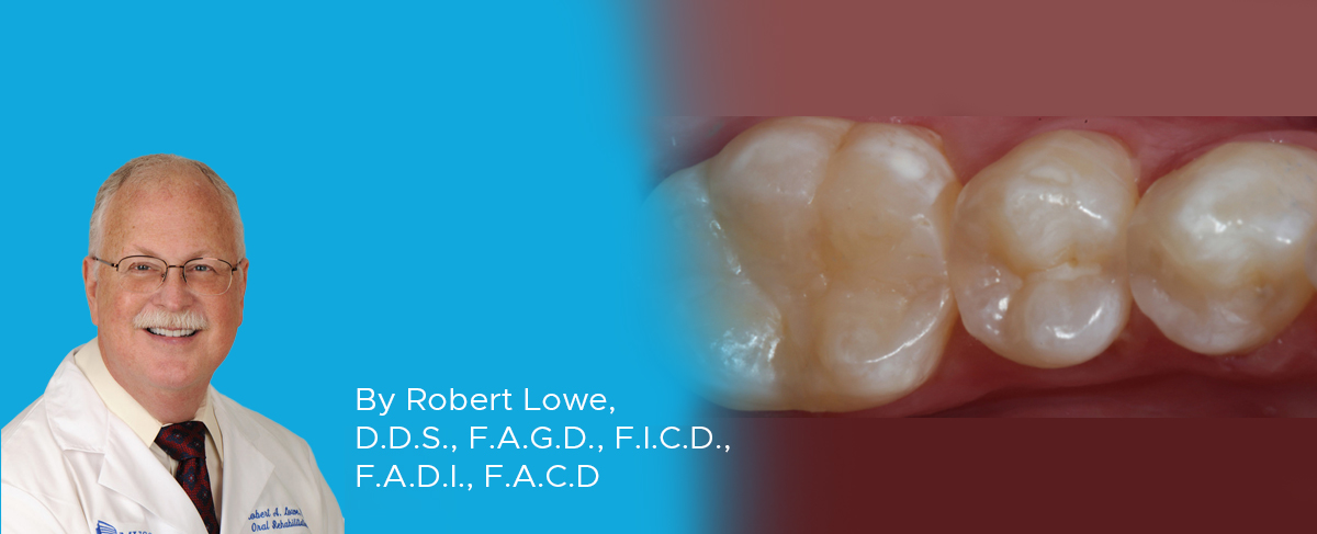 Composite Resin Restorations