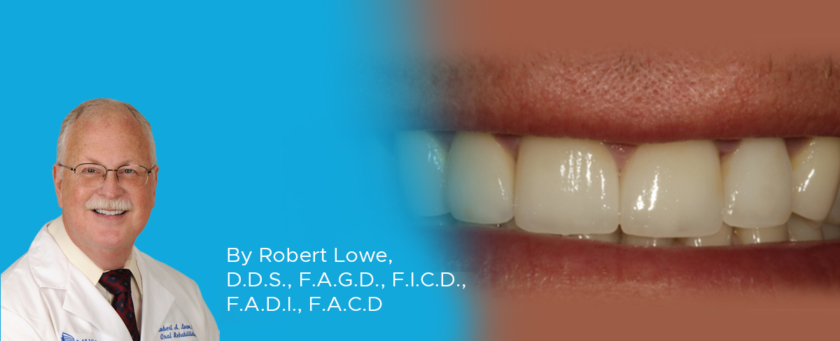 Maxillary Anterior Aesthetic Reconstruction