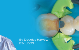 Clinical Article on Sectional Matrix System