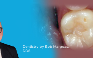 Clinical Article on Adhesive Dentistry