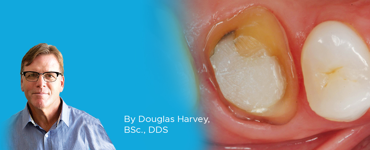 Clinical Article on Provisionalization