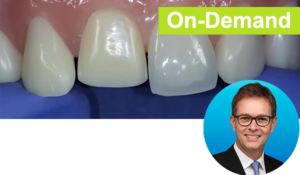 Dr. Newton Fahl The Direct-Indirect Composite Resin Veneer Course