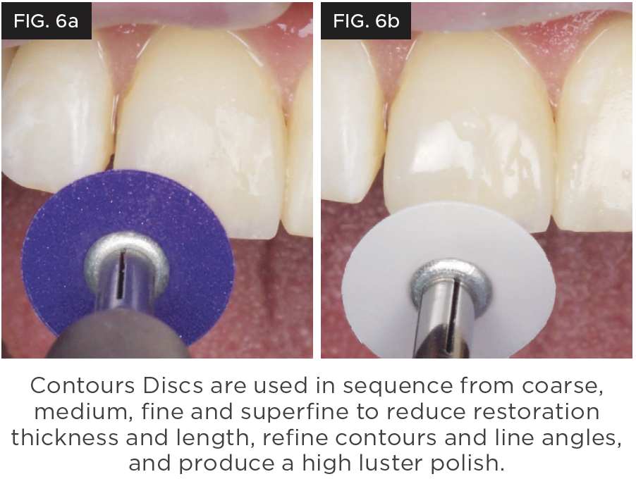 FIG 6