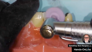 Video Image on Achieving a Superior Polishing with A.S.A.P All Surface Access Polishers