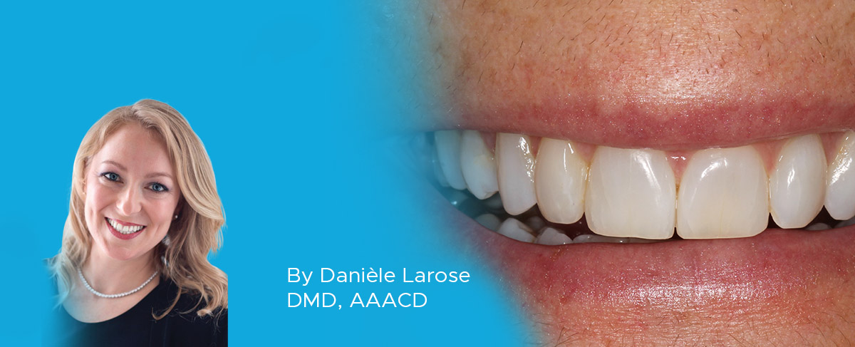 Dr. Larose article banner Resorting Incisor After Orthodontic Treatment