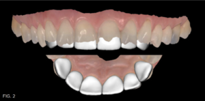 Dr. Bowes Single Opacity article - FIG 2