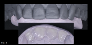 Dr. Bowes Single Opacity article - FIG 3