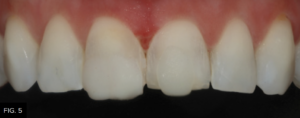 Dr. Bowes Single Opacity article - FIG 5