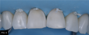 Dr. Bowes Single Opacity article - FIG 6