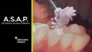 Dr. Marc Geissberger on A.S.A.P. All Surface Polishers from Clinician's Choice - Video