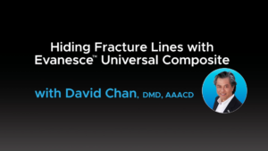 Hiding Fracture Lines with Evanesce Universal Composite - Video