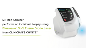 Incisional Biopsy using Bluewave™ Soft Tissue Diode Laser Dr. Ron Kaminer, DDS - Video