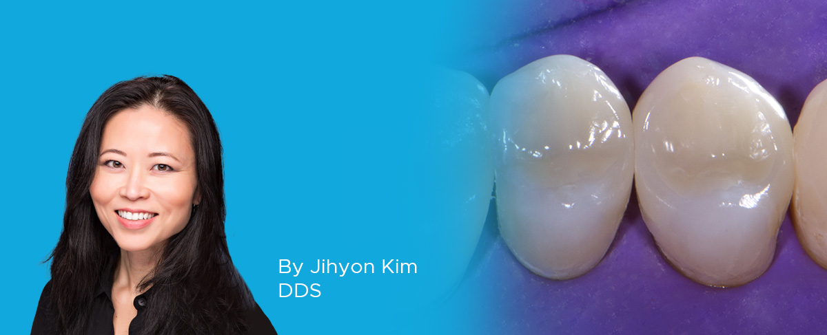 Ask-Expert-Dr-Kim- Polishing-System- article-banner