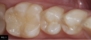 Optimizing-Aesthetics-Predictability-clinical FIG1