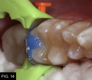 Optimizing-Aesthetics-Predictability-clinical FIG 14