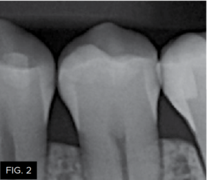 Dr-Lowe-Optimizing-Aesthetics-Predictability-clinical FIG 2