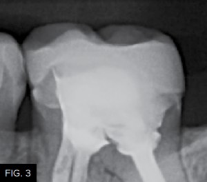 Dr-Lowe-Optimizing-Aesthetics-Predictability clinical FIG 3