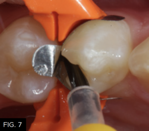 Optimizing-Aesthetics-Predictability-clinical FIG 7