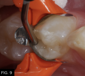 Optimizing-Aesthetics-Predictability-clinical FIG 9