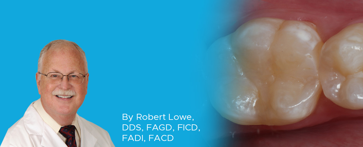 Dr. Lowe Posterior Composite Resin Restoration article banner