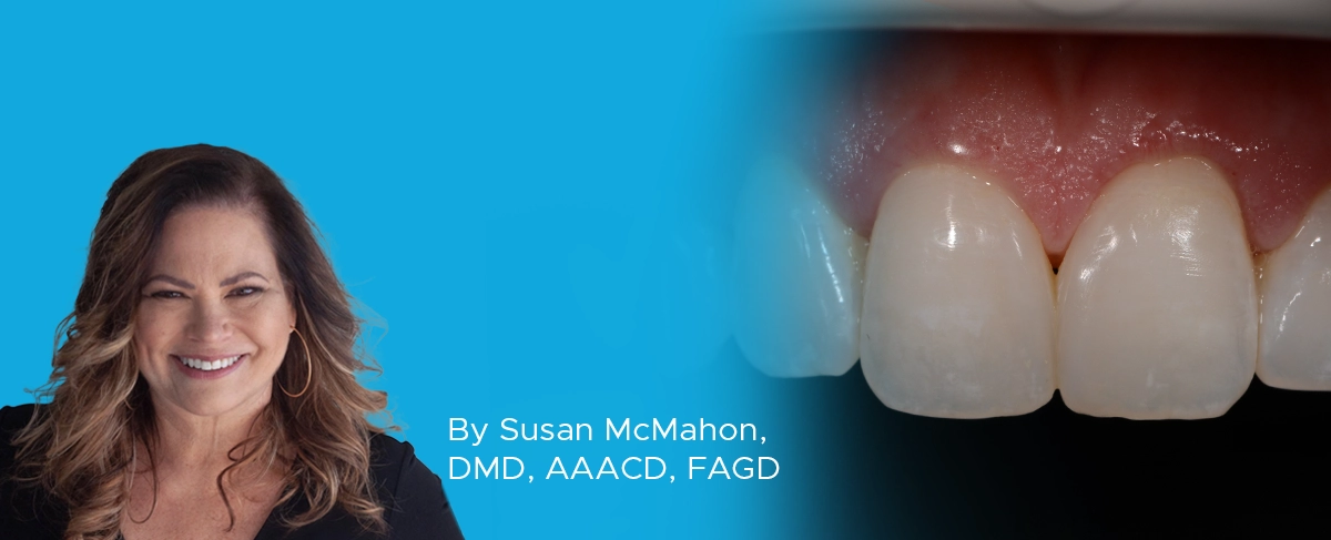 Dr. McMahon Gingival Sculpting article banner