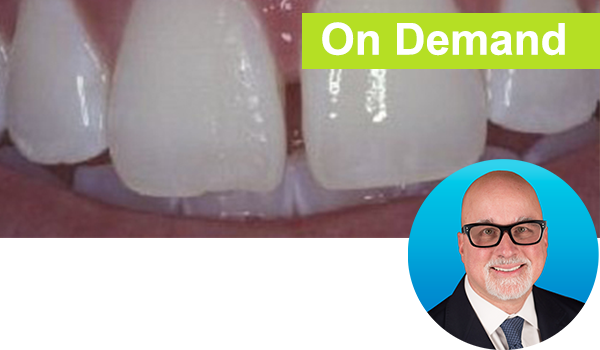 Freehand Diastema Closure Course