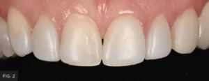 pre-operative retracted intraoral view