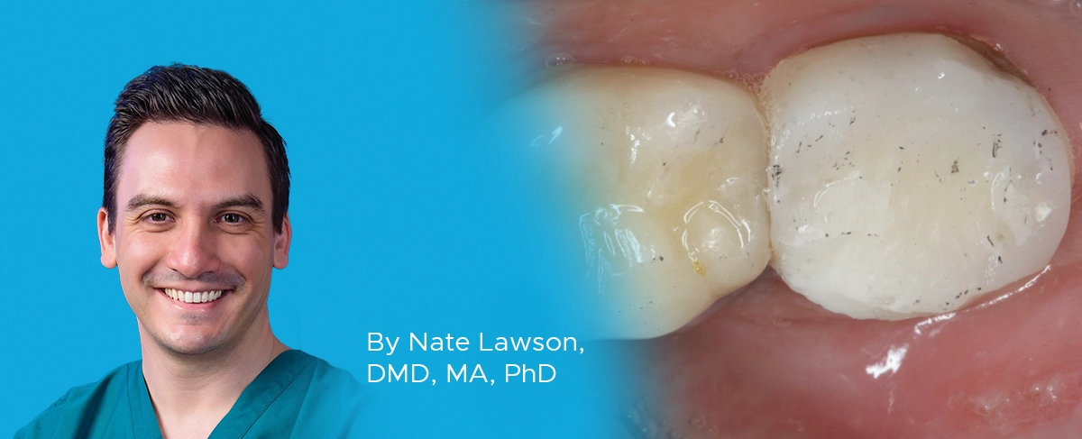 Ask the Expert, NAte Lawson, temporary restorations article banner