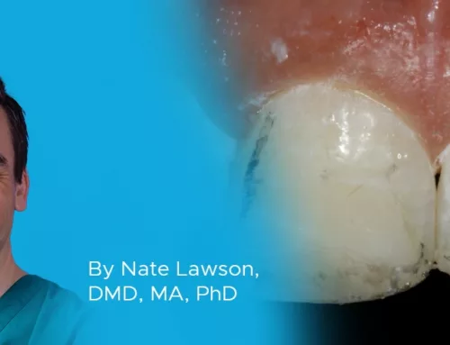 Ask the Expert: An Interview with Nate Lawson, DMD, MA, PhD on Composite Polishers