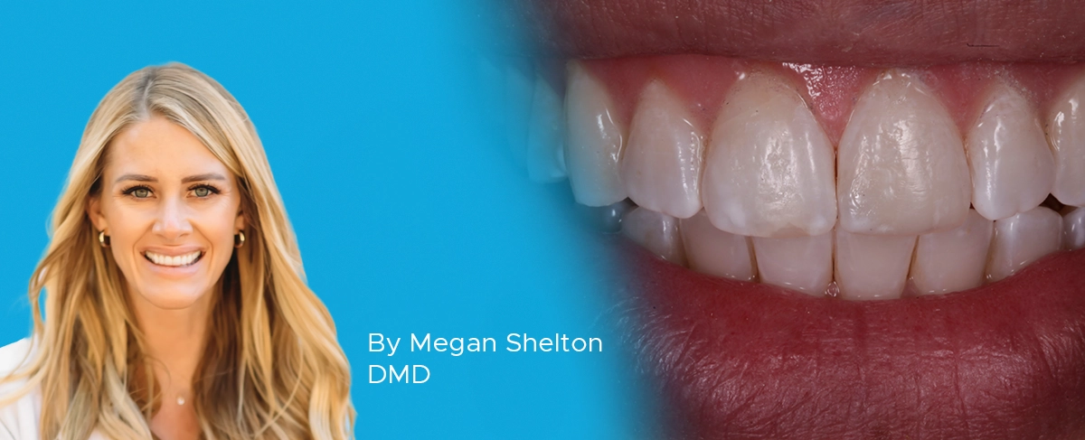 Dr. Megan Shelton multilayer composite article banner