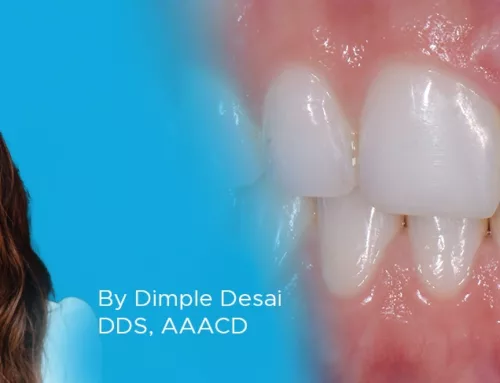 Patient Management and Treatment of the Midline Diastema