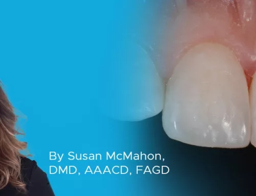 The Starburst Bevel: A Simple Solution for Enhanced Esthetics and Retention