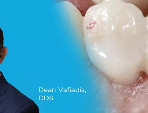 Ask the Expert: An Interview with Dean Vafiadis, DDS on Adjusting and Polishing Zirconia Restorations