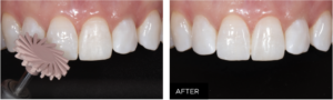 restorative clinical, before & after