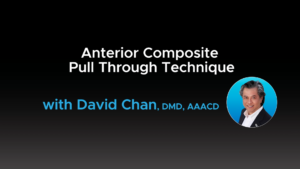 Anterior Composite Pull Through Technique with David Chan, DMD, AAACD - Video