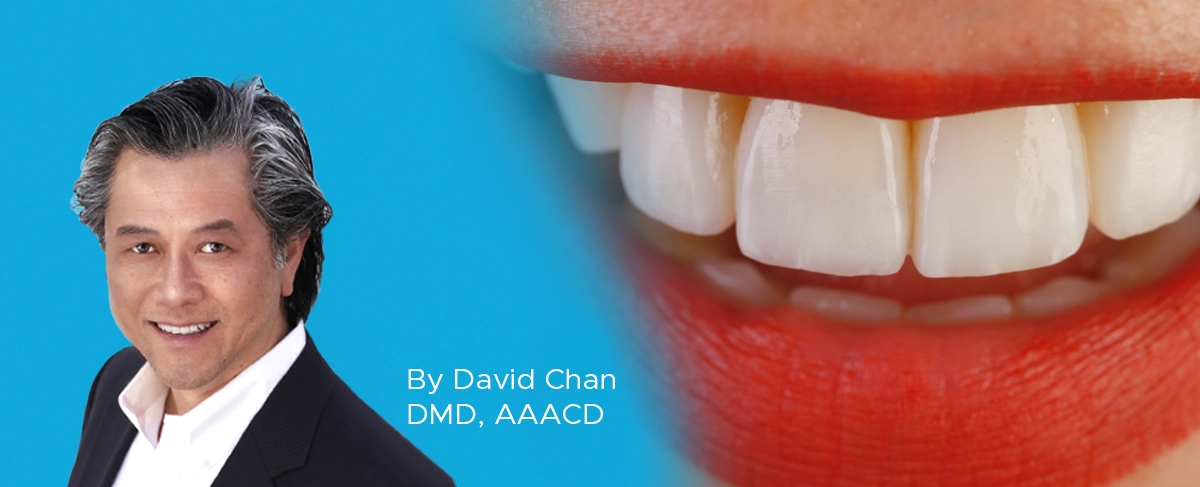 Dr. David Chan Anterior Composite Restoration article banner