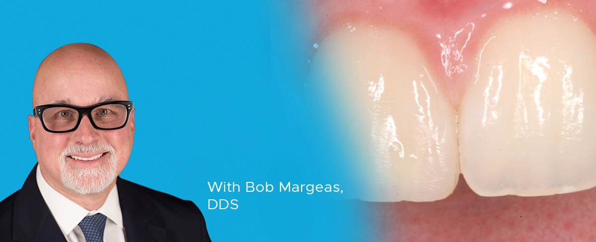 Bob Margeas Ask Expert Universal Composites article banner