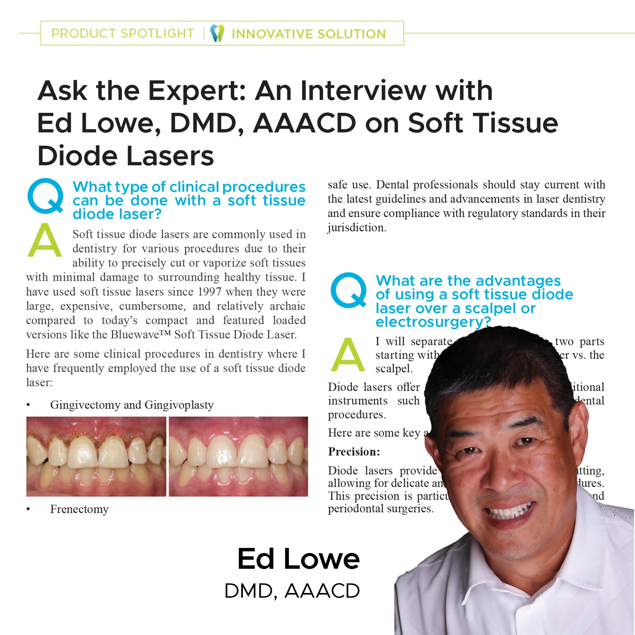 social media thumbnail Ask Expert article Dr. Ed Lowe Bluewave soft tissue diode laser