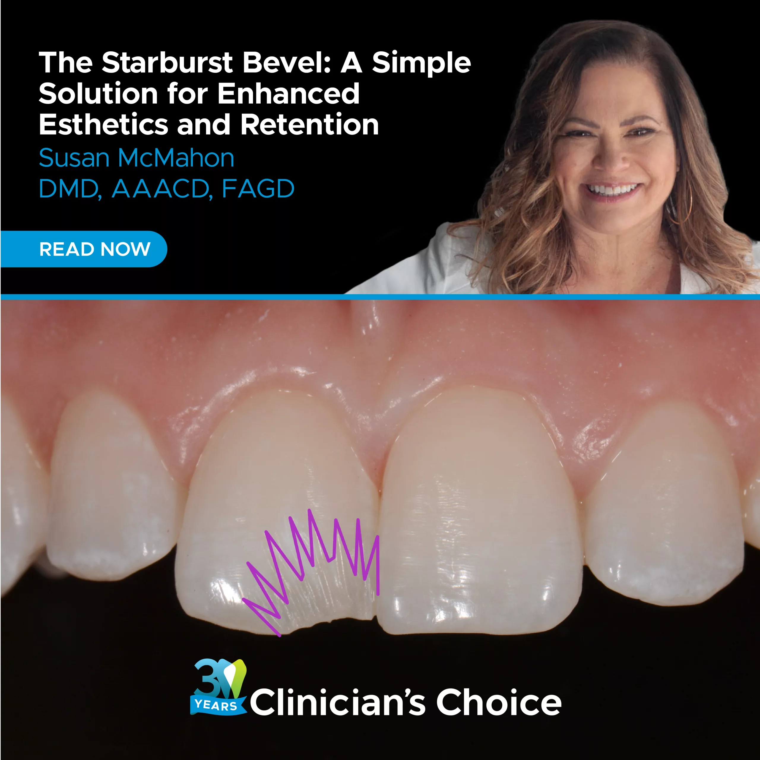 social thumbnail Dr. McMahon article Starburst Bevel